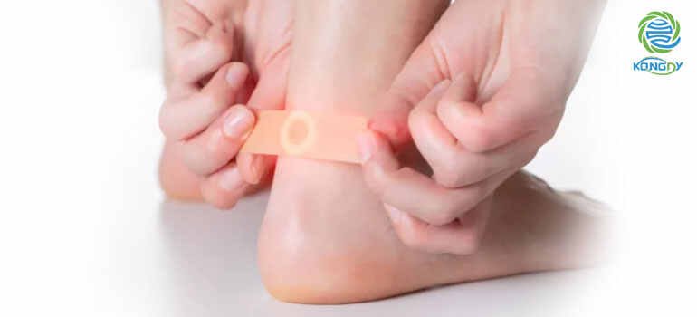 kongdymedical|Kangdi Corn Removal Plaster OEM Service