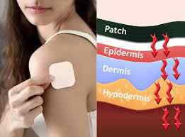 transdermal patches.jpeg